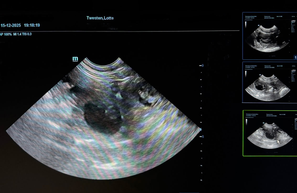 Ultraschallbild mit mehreren kreisförmigen Strukturen auf einem Bildschirm, umgeben von Text und kleineren Bildausschnitten auf der rechten Seite.